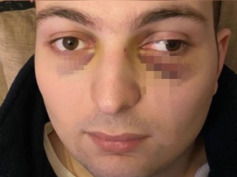 Ticarət mərkəzində döyülən oğlanla bağlı araşdırma BAŞLADI
