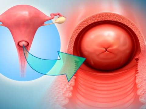 Gürcüstanda uşaqlıq boynu xərçənginin müayinəsi ilə bağlı YENİLİK