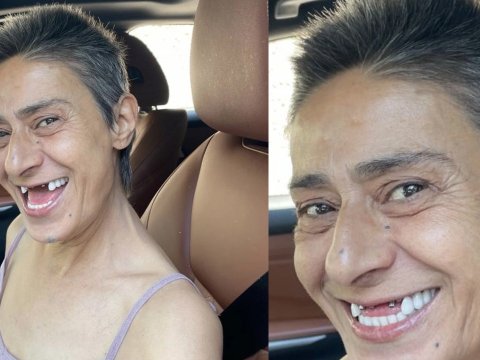Sosial mediada dişsiz şəklini paylaşdı - FOTO