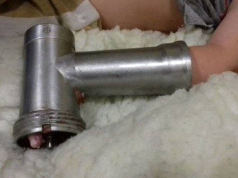 13 yaşlı qızın barmaqları ətçəkən maşında qaldı