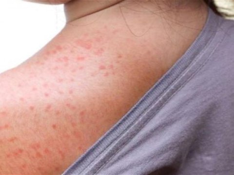 17 yaşlı qız qlzılcadan ÖLDÜ