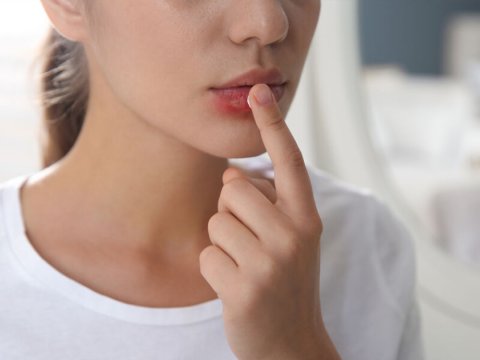 Alimlər herpes virusunun sinir sisteminə necə daxil olmasını araşdırıblar