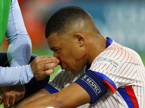 Mbappe Avropa Çempionatının oyunlarını buraxacaq - Burnu sındı