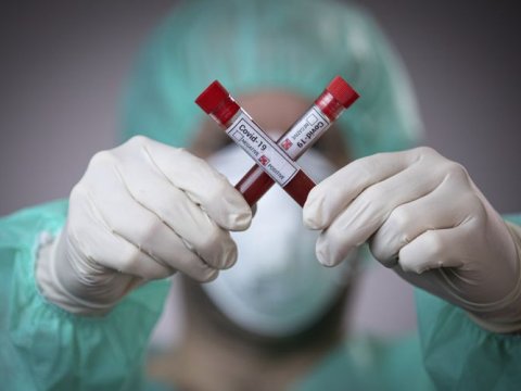 Ermənistanda koronavirusa yoluxma halları ARTIR