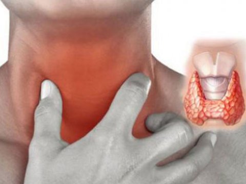 Zob xəstəliyi olanlar əsgərliyə aparılmır? - AÇIQLAMA