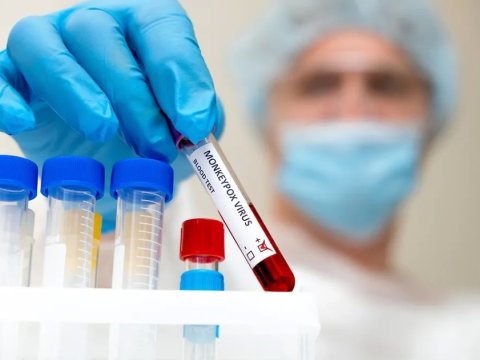 Daha bir ölkədə meymunçiçəyi aşkarlandı