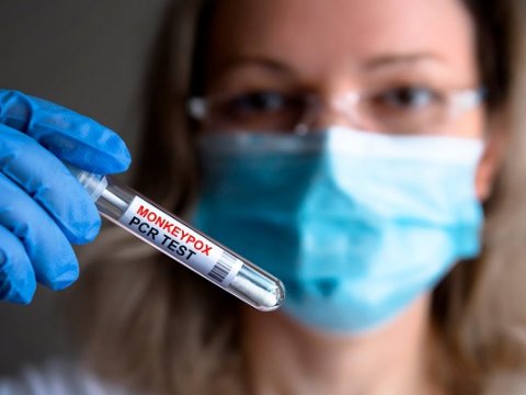 Meymunçiçəyi ilə bağlı daha bir qurum məlumat YAYDI