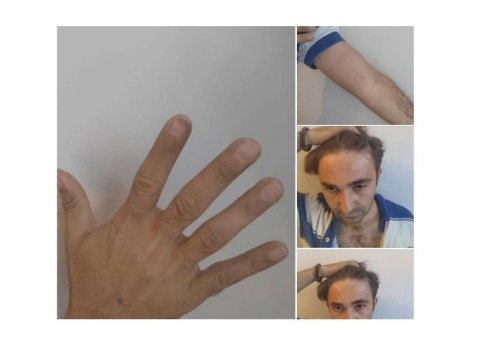 Deputatlığa namizədin vəkilinə zorakılıqla bağlı araşdırma aparılır