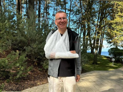 Latviya prezidenti biləyini və barmağını sındırdı