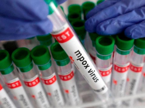 Afrikada 35 min nəfər meymunçiçəyinə&nbsp;yoluxub