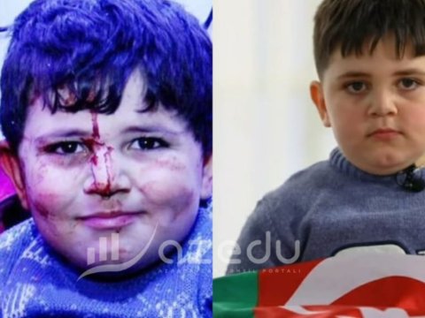 Gəncə terrorunun balaca qurbanı: "Polad Həşimov kimi olmaq istəyirəm"&nbsp;