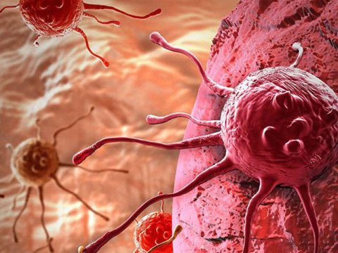 Azərbaycanda xərçəng xəstəliyi niyə çoxalıb? - VİDEO