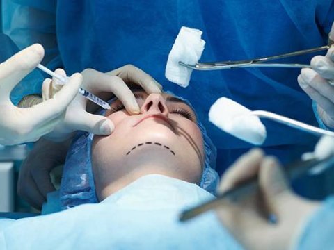 Prokurorluq saxta plastik cərrahlarla bağlı HƏRƏKƏTƏ KEÇDİ - 18 NƏFƏR...