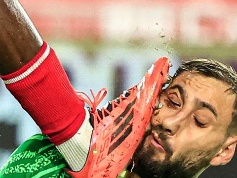 Həmin zərbədən sonra üzünə 10 tikiş vuruldu - FOTO