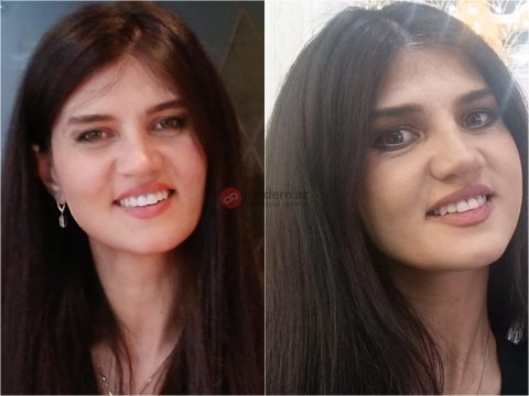 Hökümənin nəşi bu gün təhvil veriləcək