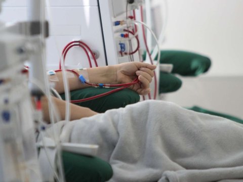 Azərbaycanda böyrək çatışmazlığından əziyyət çəkənlərin sayı&nbsp;AÇIQLANDI