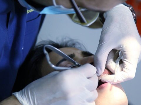 Azərbaycanda stomatoloq sayı azalıb? - Tibb Universitetindən AÇIQLAMA