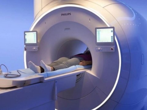 Müştərək maliyyələşmə məbləğinin tətbiqi sadələşdirilir