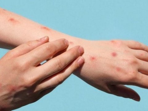 Azərbaycan endemik ölkələr siyahısına daxil deyil - RƏSMİ