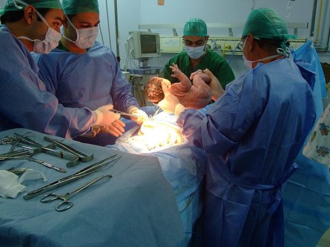 26 yaşlı ana qeysəriyyə əməliyyatından sonra ÖLDÜ