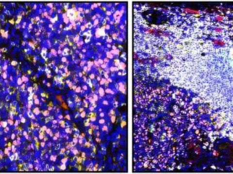 Alimlərdən xərçənglə mübarizədə yeni kəşf