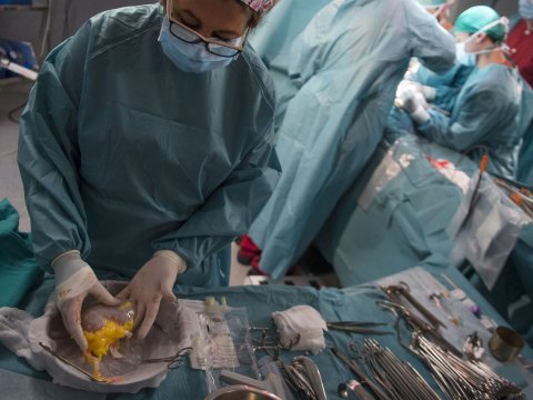 Azərbaycanda ilk -&nbsp;Meyit donorun orqanları transplantasiya edildi