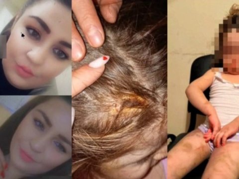 Azyaşlı qızına işgəncə verən ana ilə bağlı HƏBS QƏRARI