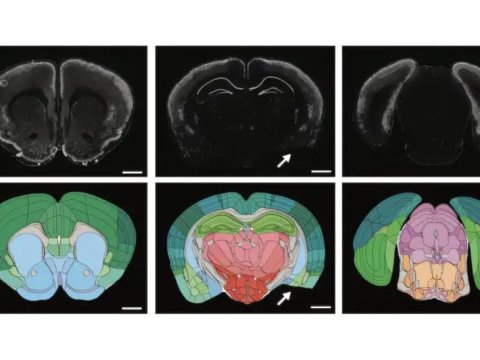 Yeni proqram beyin xəritələndirilməsini sürətləndirir