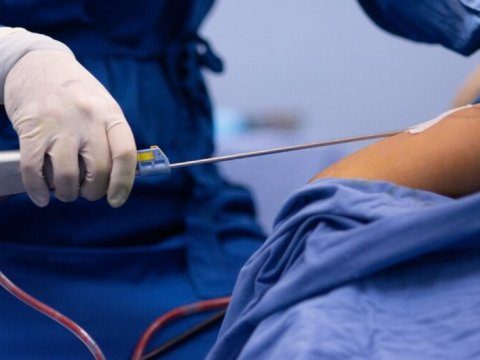 34 yaşlı qadın liposaksiyadan sonra ÖLDÜ