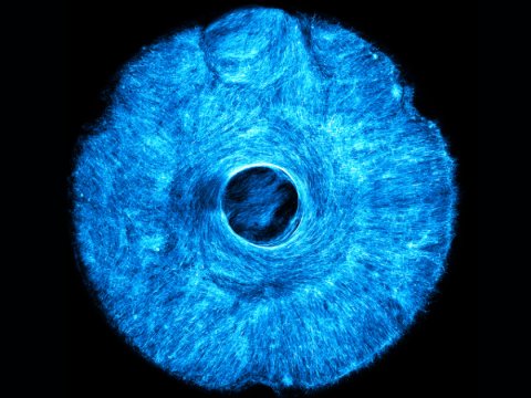 Gözün ilk süni qüzehli qişası yaradılıb