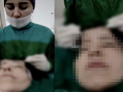 Həkim üzgərmə əməliyyatında canlı yayım açdı - Araşdırma BAŞLADI