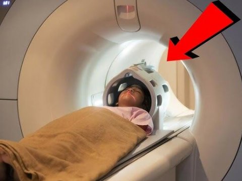 Kompüter tomoqrafiyası xərçəngə səbəb olur - Yeni araşdırma