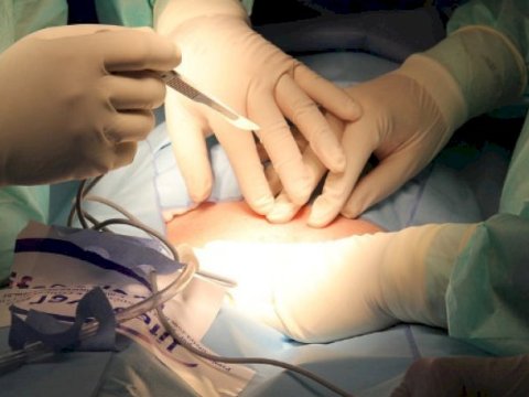 Azərbaycanlı gənc böyrəyini 200 min dollara SATIB