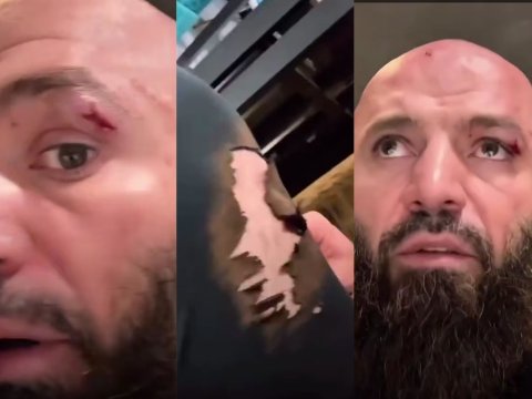 "Powerbank"ın partlaması məşhur döyüşçünü ağır yaraladı