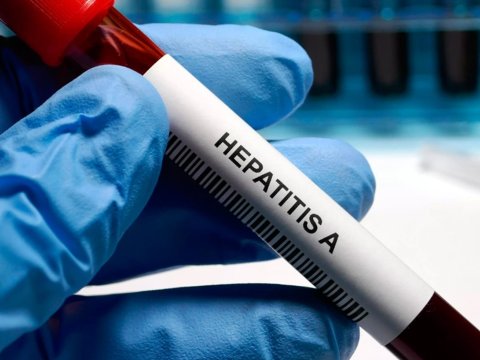 Avropada həyəcan təbili: Hepatitə&nbsp;yoluxma kəskin artır