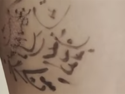 Uşağın xəstə ayağına dua yazdılar - Azərbaycanda biabırçı HADİSƏ