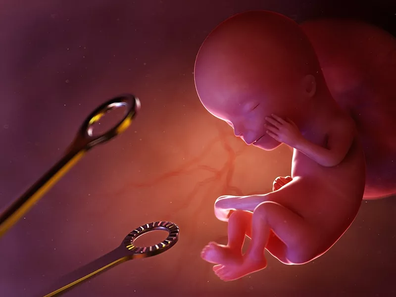 Azərbaycanda abortların sayı 5 minə yaxın ARTIB