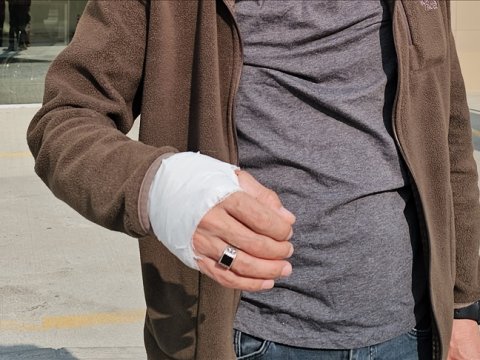 Türkiyədə 14 min nəfər qurban kəsərkən yaralanıb