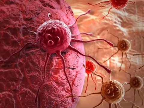 Xərçəng xəstələrinin sayı artır - Nazir