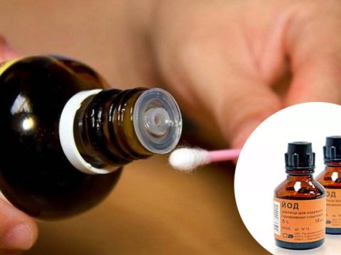 Azərbaycanda klassik yod niyə TAPILMIR...