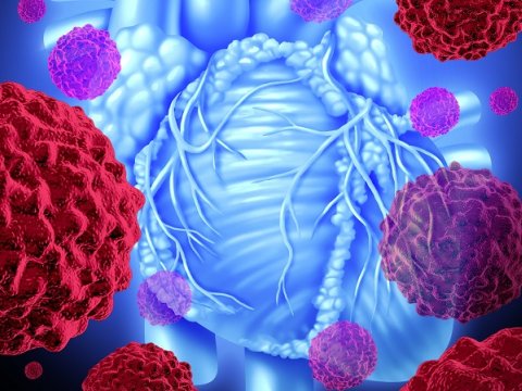 Azərbaycanda ürək-damar xəstəlikləri və xərçəngə tutulma - Risk faktorları açıqlandı