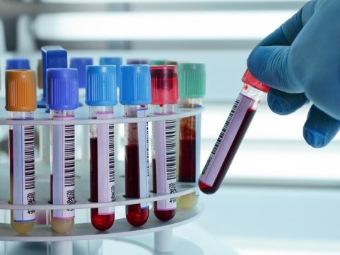 Azərbaycanda ötən il 634 nəfərdə hepatit aşkarlanıb