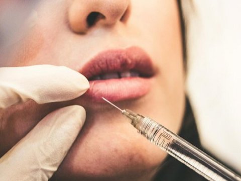 Azərbaycanda qadınlara botoksla bağlı XƏBƏRDARLIQ EDİLDİ