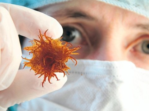 Azərbaycanda xərçəngin yayılan formaları - Qorxunc STATİSTİKA