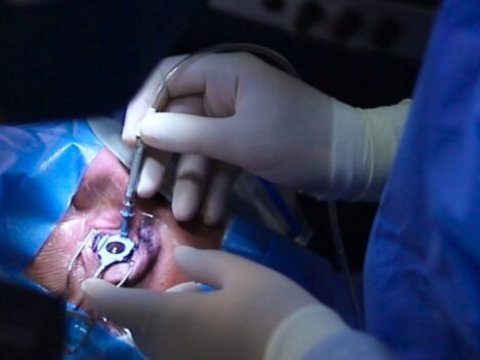 Görməsini itirən xəstə əməliyyatdan sonra 100% görməyə başladı