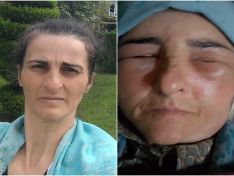 Qonşular dalaşdı - 51 yaşlı qadın xəstəxanalıq oldu