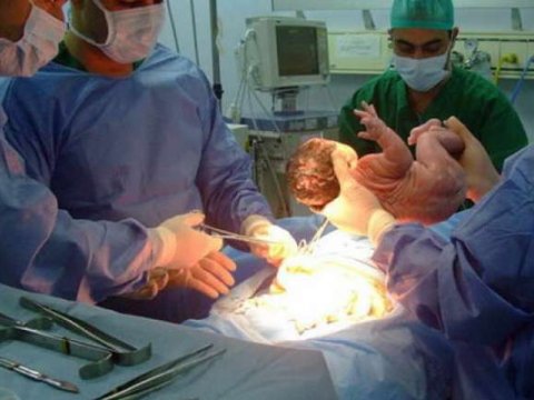 Ağcəbədidə ana doğuş zamanı öldü 