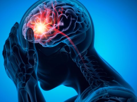 İnsultdan sonra beyin hüceyrələrini bərpa edən terapiya üsulu hazırlandı