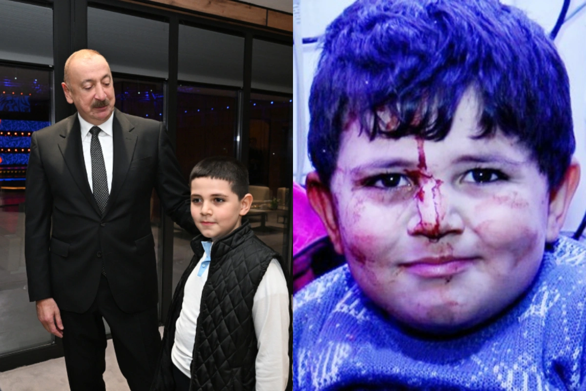 Gəncə terrorunun canlı şahidi - Bəxtiyar - FOTOLAR