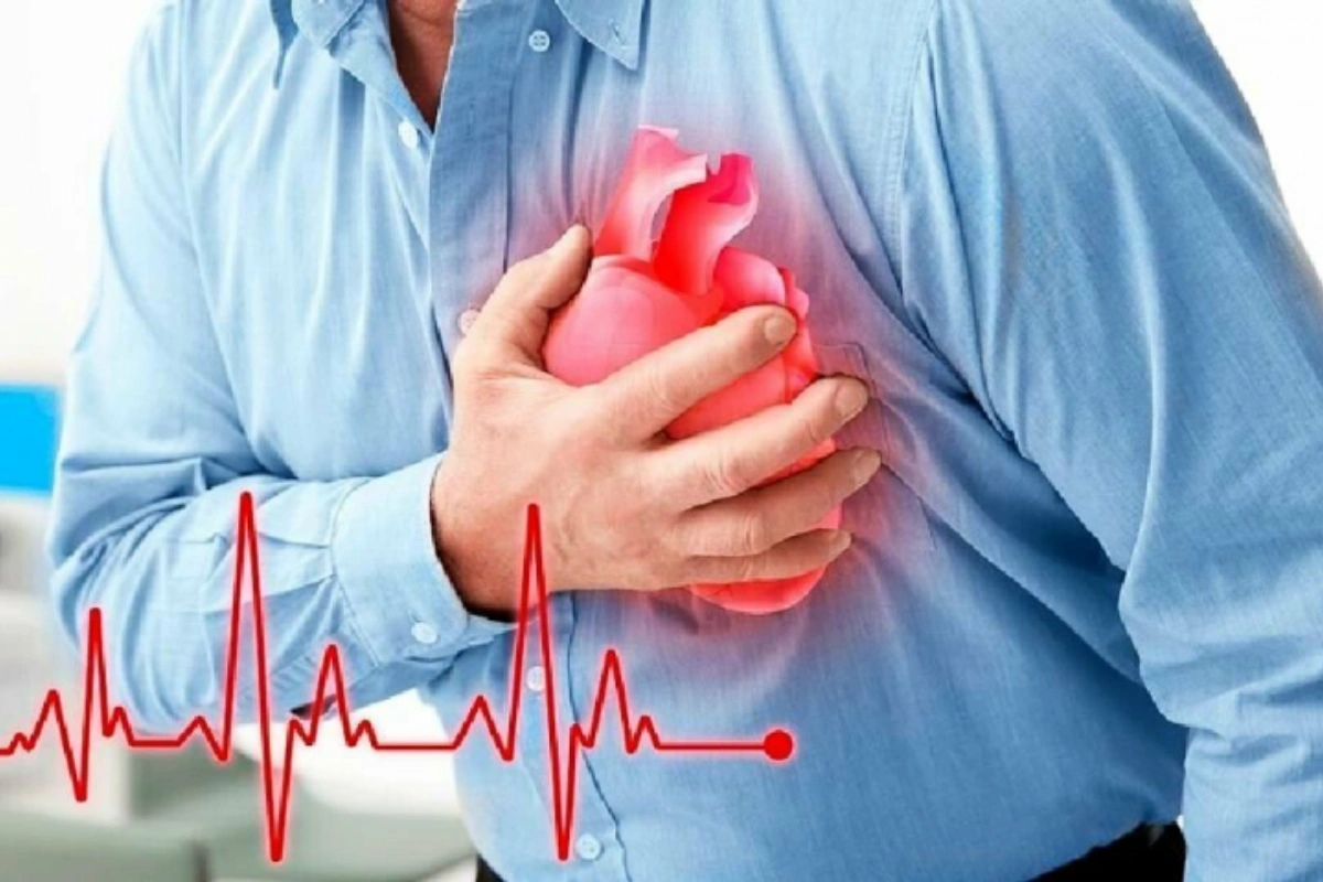 Son beş ildə Azərbaycanda neçə nəfərə infarkt diaqnozu qoyulub?